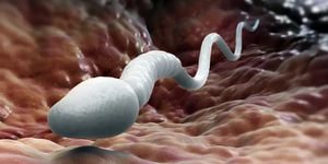 Сперматозоида фото